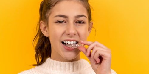 Three things to know about getting invisalign treatment for your teeth